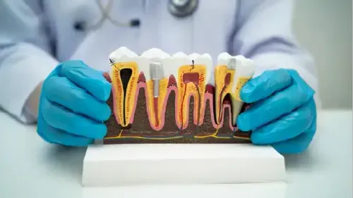 What is the Cost of a Single Root Canal Treatment in Gurugram?